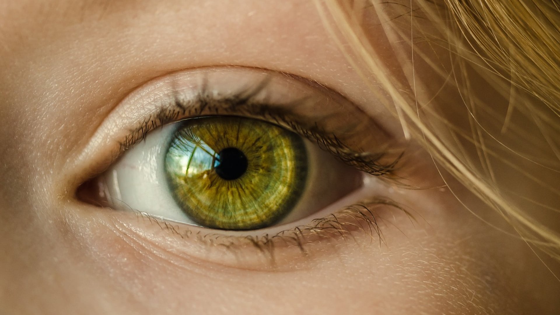 Gros plan d'un œil humain avec un iris vert, après une chirurgie au laser.