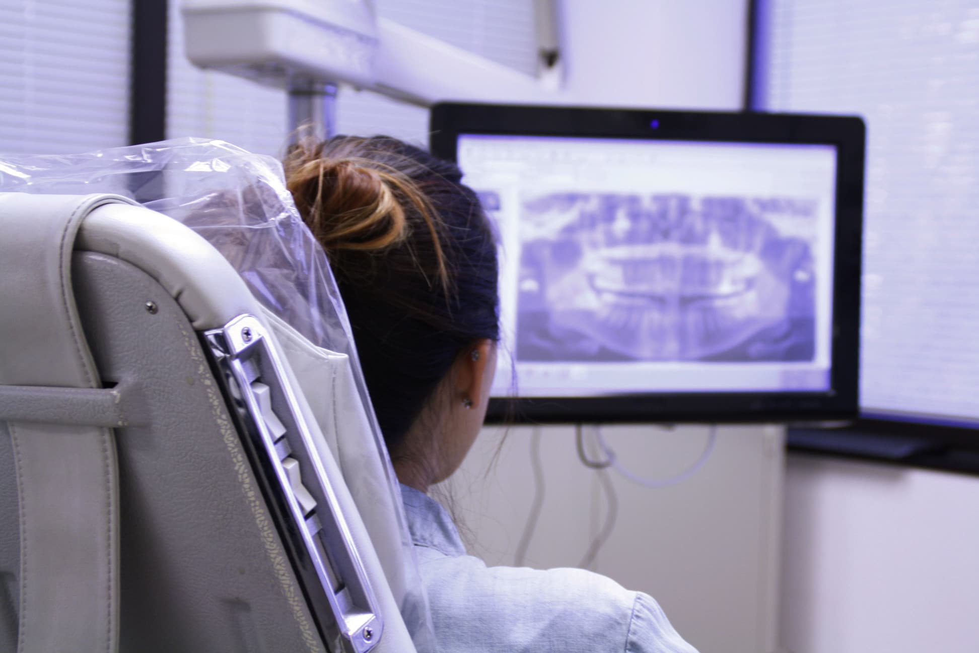 Un patient est assis dans un fauteuil dentaire et regarde une radiographie des dents affichée sur un écran d'ordinateur, discutant de son traitement orthodontique lingual.