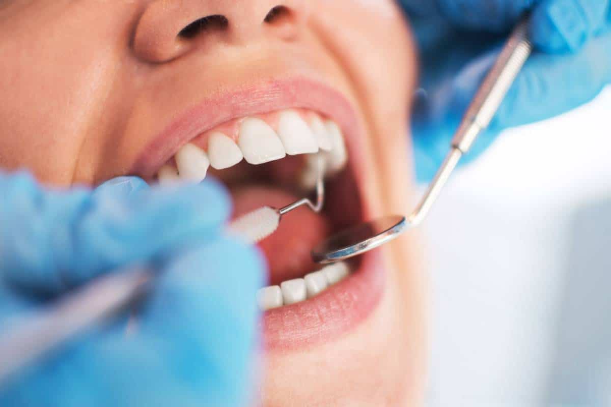 Examen dentaire en cours avec des outils inspectant les dents pour des soins dentaires.