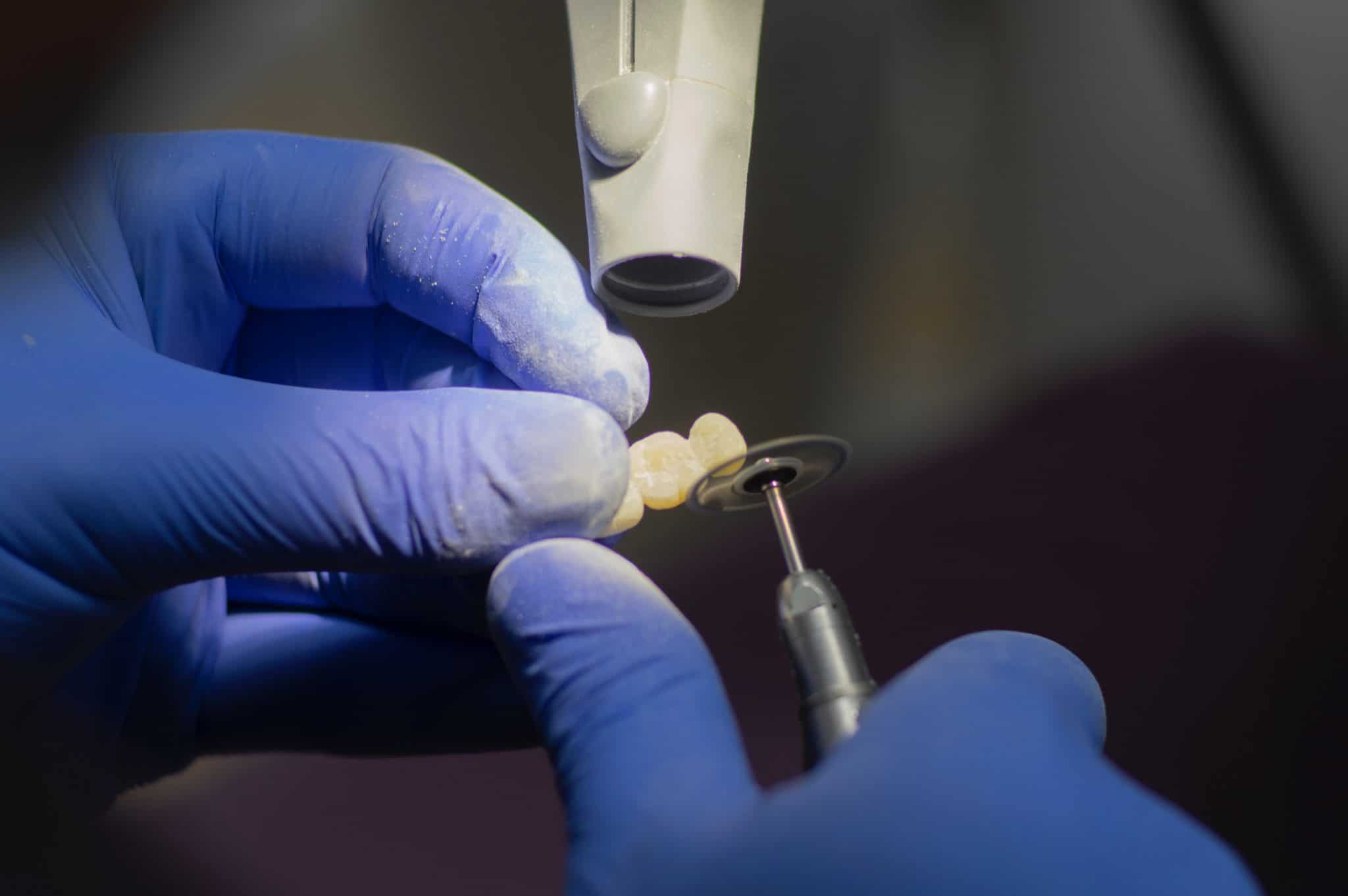 Technicien dentaire travaillant sur une dent prothétique avec des outils de précision.