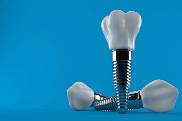 Pourquoi les implants dentaires sont-ils si chers ?