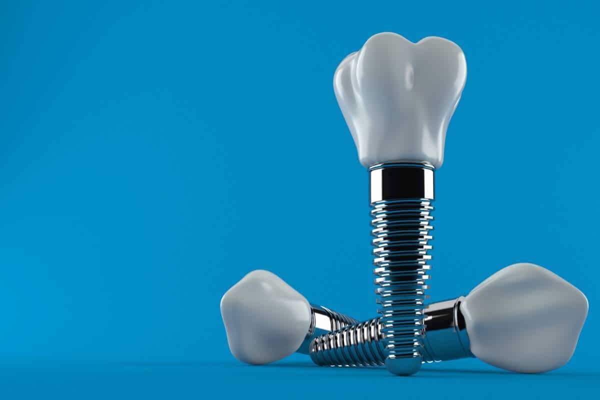 Une illustration 3D de trois implants dentaires sur fond bleu.