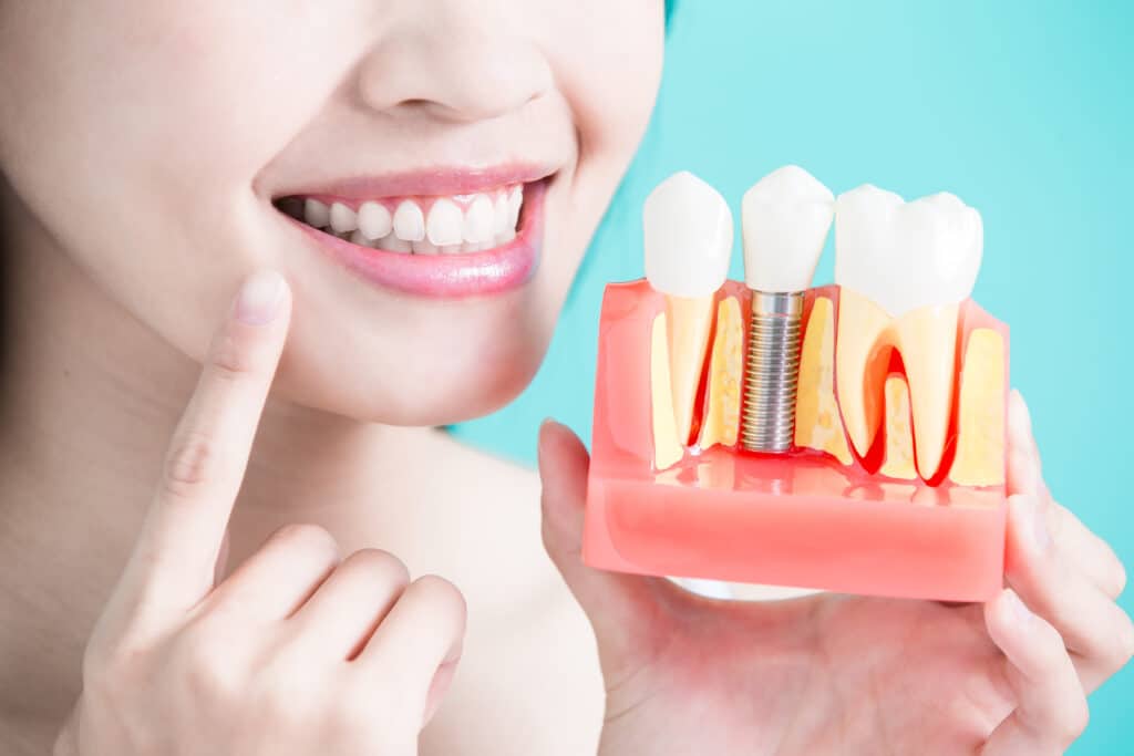 Est-ce que c'est douloureux de se faire poser un implant dentaire ?