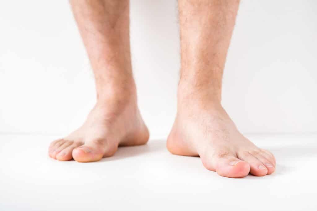 Quelles sont les différentes formes de pieds ?