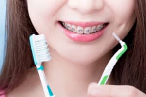 Les brosses à dent spéciales appareil dentaire