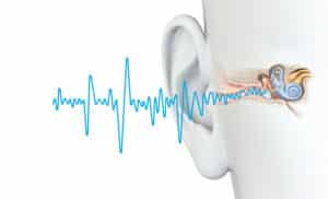 les acouphènes font parties des troubles auditifs fréquents au Printemps et en Été