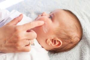 Quelles précautions prendre lors du traitement de l'eczéma atopique chez les bébés ?