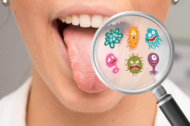 Quelles sont les infections de la bouches les plus courantes ?